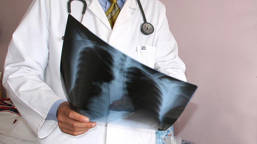 Akciğer kanserinde ‘kombine tedavi’